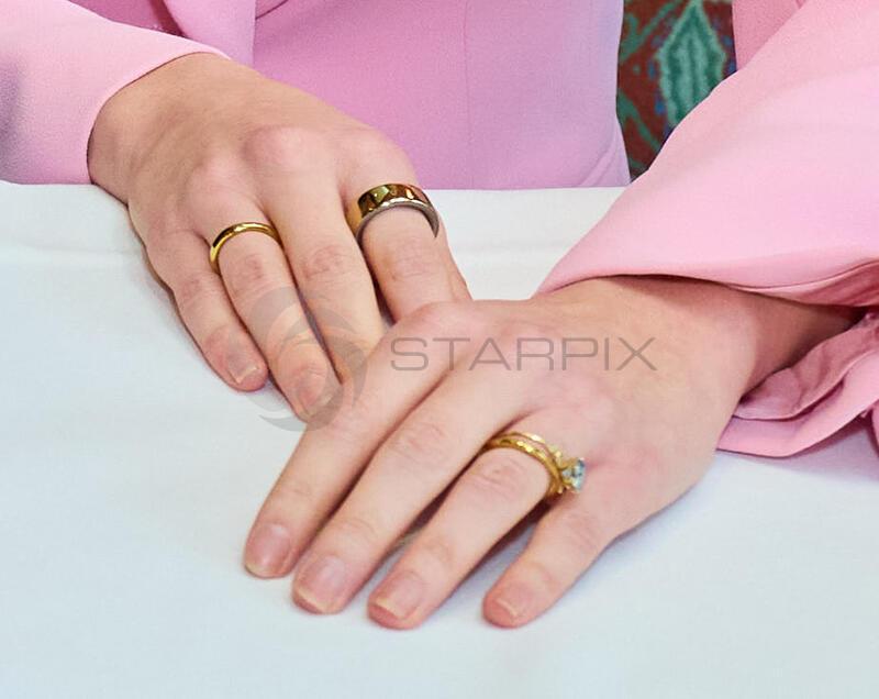 Copyright: Starpix / A. Tuma, 11.03.2026 Wien , KALEEN Hand, Ringe, Ehering, ,  ESC-Sängerin Kaleen tritt Vitiligo Hilfe Österreich - Pressekonferenz im Cafe Landmann