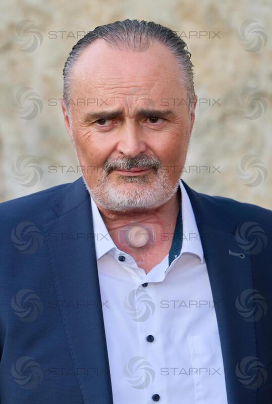 Copyright: Starpix / A. Tuma, 15.07.2026 St. Margarethen , Portrait nach Operation , Hals, Narben,  , Premiere Oper im Steinbruch St. Margarethen "Tosca"Premiere Oper im Steinbruch St. Margarethen "Tosca"